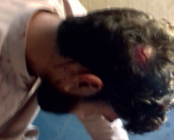 Ahmadi injured in attack